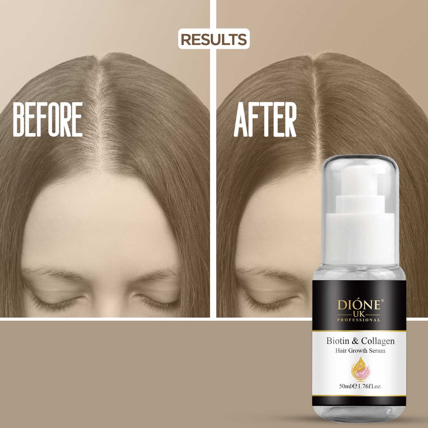 Dione UK Biotin Hair Growth Serum (50ml)